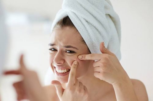 How to treat acne