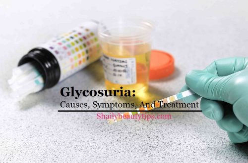 Glycosuria